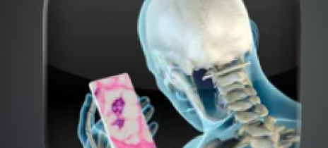 Charity funds new tumour treatment app